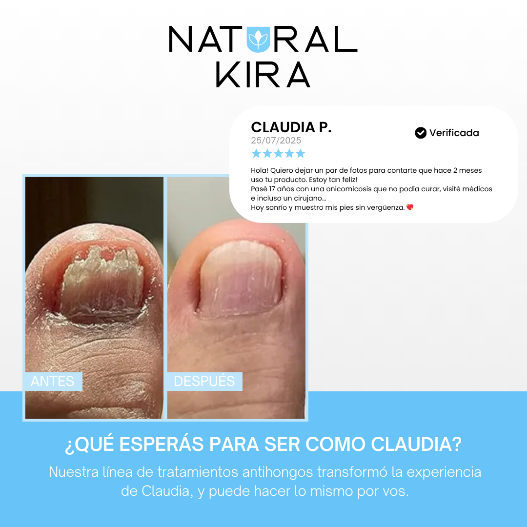 Crema para Hongos de los PIES - 50ml