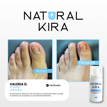 Crema para Hongos de los PIES - 50ml