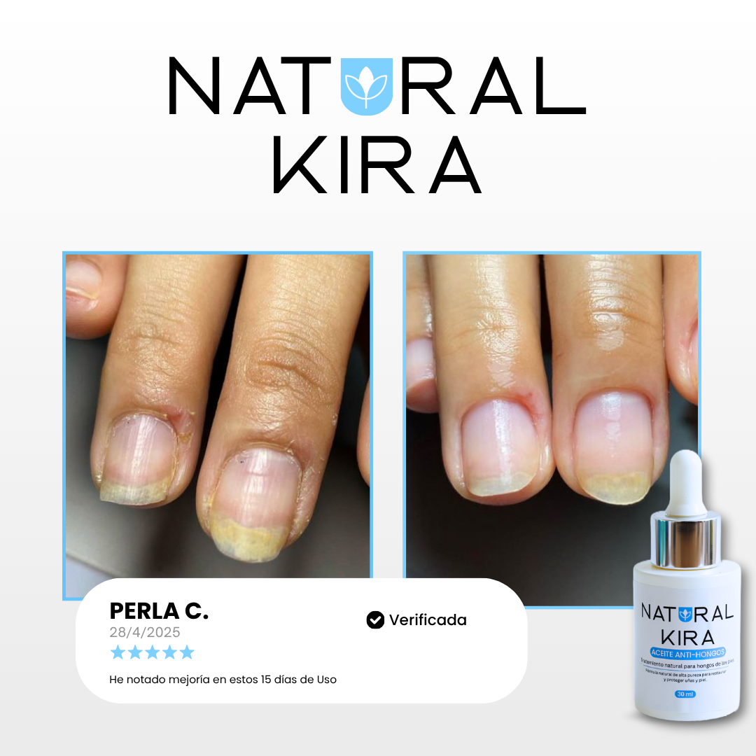 Aceite para Hongos de los PIES - 50ml